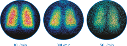 经鼻高流量湿化氧疗，有效药物输送